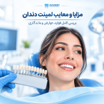 مزایا و معایب لمینت دندان