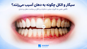 تأثیر سیگار و الکل بر دندان