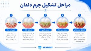 جرمگیری دندان