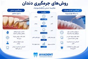 جرمگیری دندان