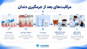 جرمگیری دندان