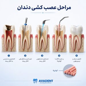 گوتاپرکا چیست؟