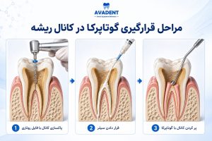گوتاپرکا