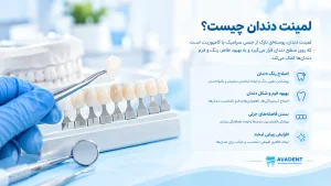 مزایا و معایب لمینت دندان
