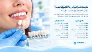 مزایا و معایب لمینت دندان