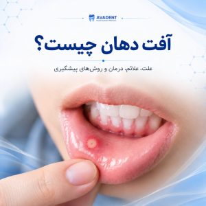 آفت دهان چیست؟