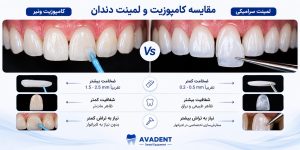 کامپوزیت و لمینت؟