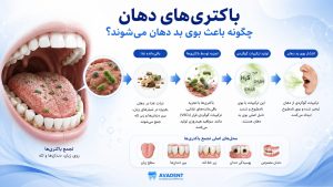 بوی بد دهان