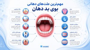 بوی دهان دهان