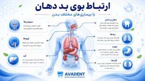 بوی بد دهان