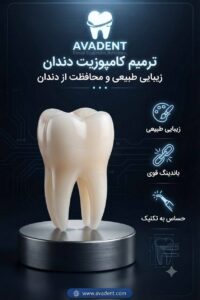 آمالگام یا کامپوزیت ؟