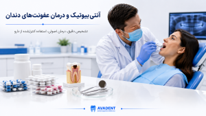 انواع داروهای دندانپزشکی