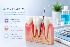 انواع داروهای دندانپزشکی