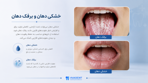 انواع داروهای دندانپزشکی