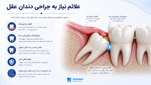 جراحی دندان عقل