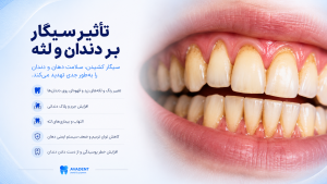 تأثیر سیگار و الکل بر دندان