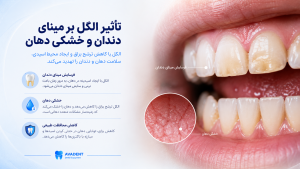 تأثیر الکل بر دندان