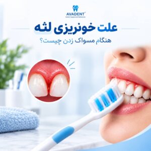 علت خونریزی لثه هنگام مسواک زدن چیست؟