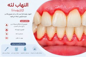 علت خونریزی لثه هنگام مسواک زدن چیست؟