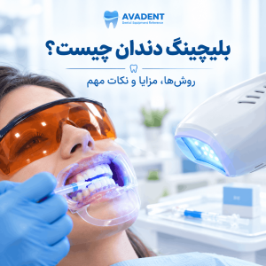 بلیچینگ دندان چیست